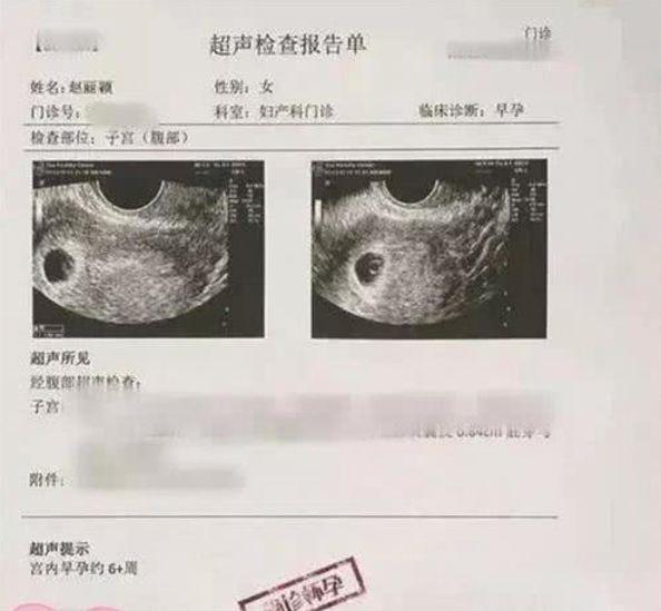 赵丽颖孩子是谁的(冯绍峰宣布赵丽颖诞下男宝，终于升级爸爸妈妈！)